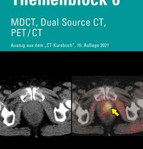 CT Course Book - MDCT, Dual-Source CT, PET/CT