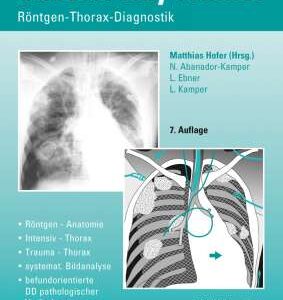 Chest X-Ray Trainer - Buch