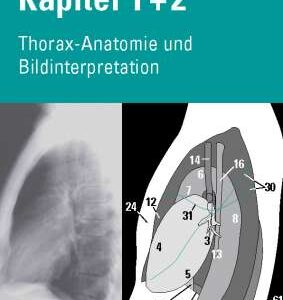 Chest X-Ray Trainer - Thoracic Anatomy & Image Interpretation