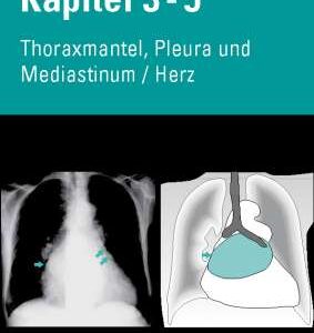 Video Bundle CXR Kap. 3-5
