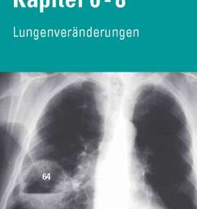 Video Bundle CXR Kap. 6-8