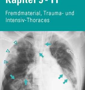 Video Bundle CXR Kap. 9-11